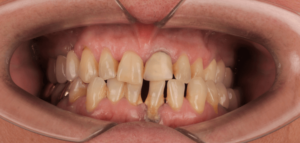 BeforeAfter Dental Elite14