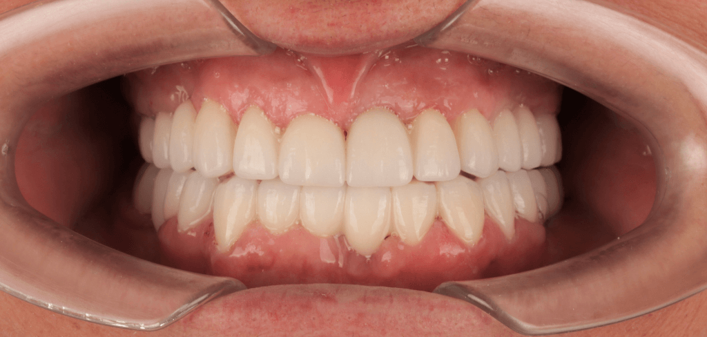 BeforeAfter Dental Elite15