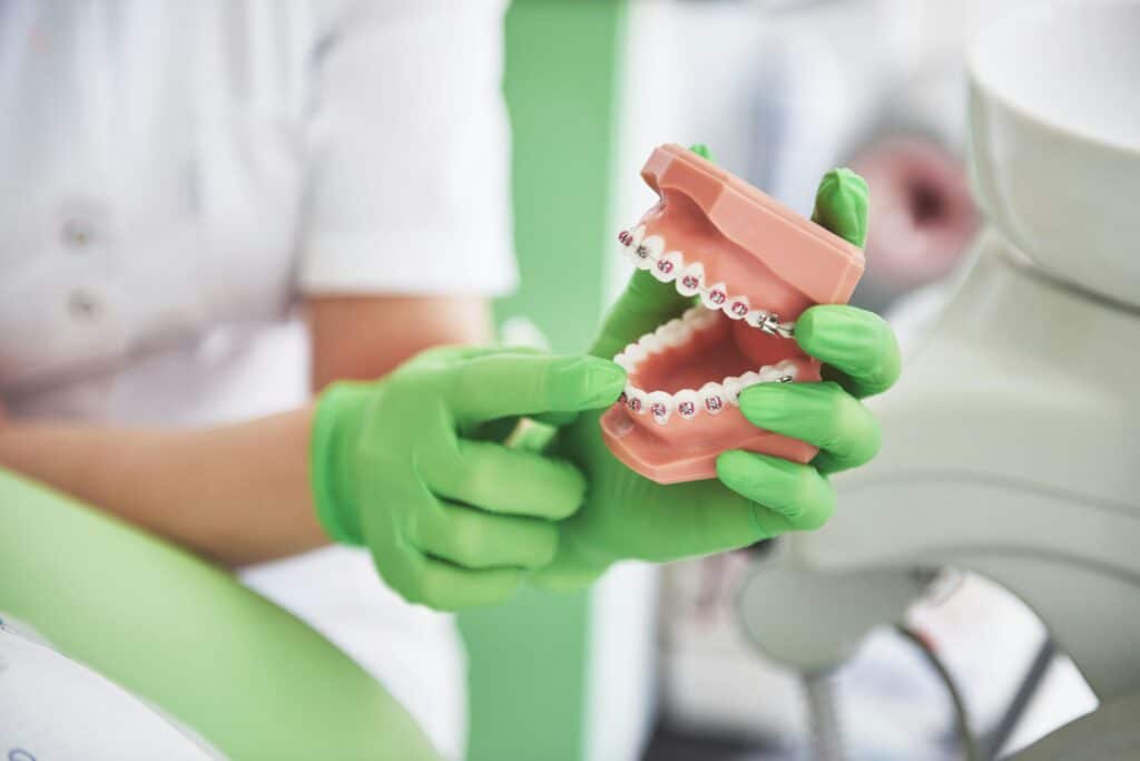 Medic care arata gingia pe un mulaj dentar
