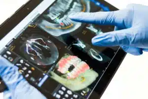 Medic care arata un implant dentare, pe radiografia panoramica