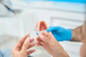 Cum alegi un aparat dentar
