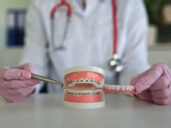 Medic stomatolog care arata spre un mulaj dentar cu apratat cu brackeți