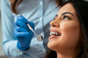 tipuri de aparat dentar