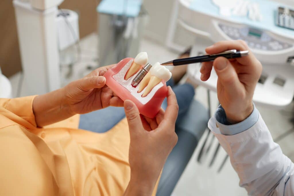 Diferență implant dentar imediat vs clasic