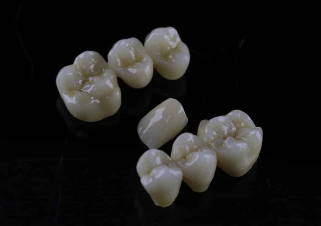 Coroane dentare din ceramica (portelan), pe o masa