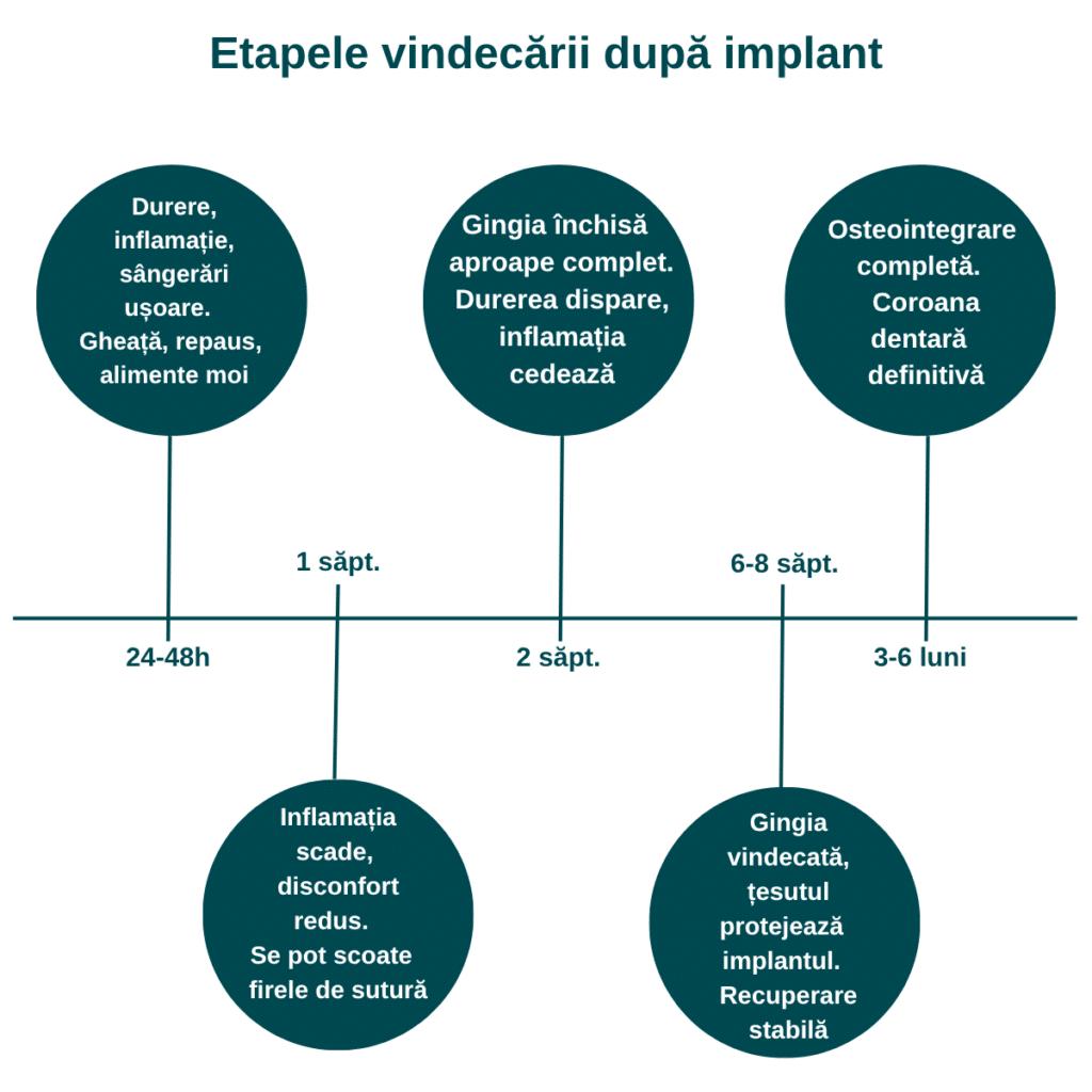 Chronologie des étapes de la cicatrisation après la pose d'un implant dentaire