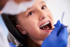 Fetita cu aparat dentar, la control, la stomatolog