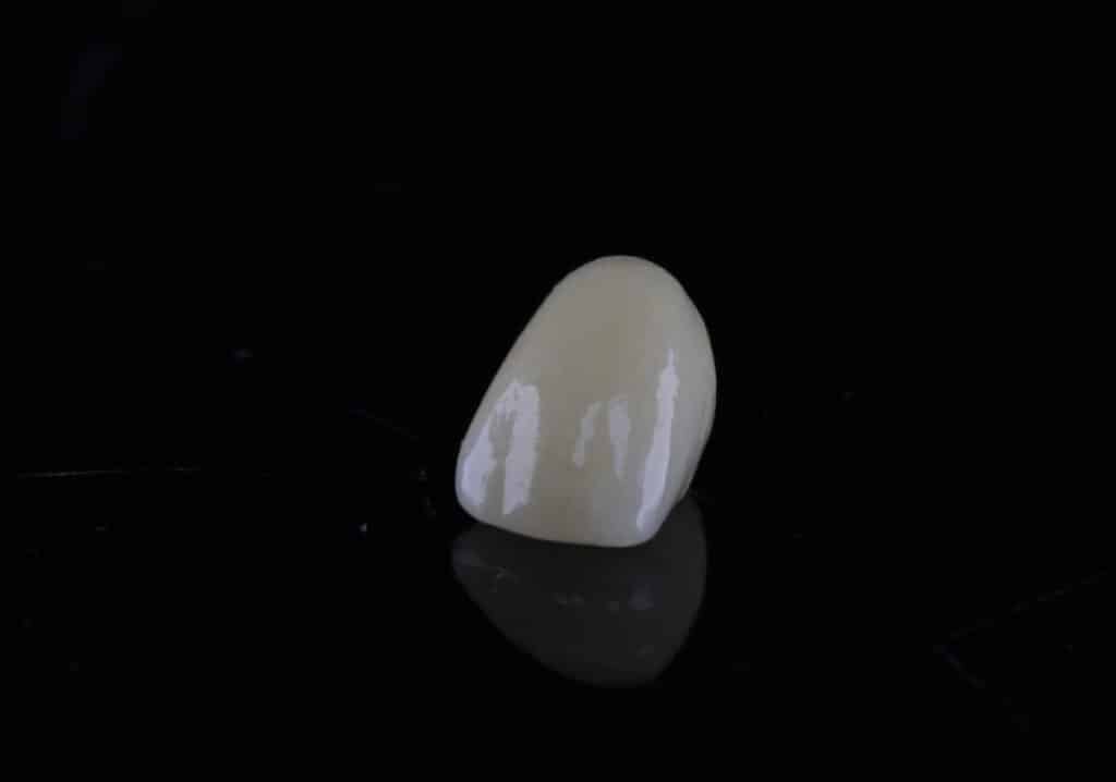 Coroana dentara pe masa