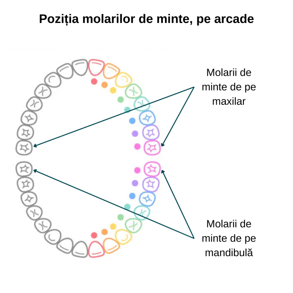Pozitia maselelor de minte pe arcade