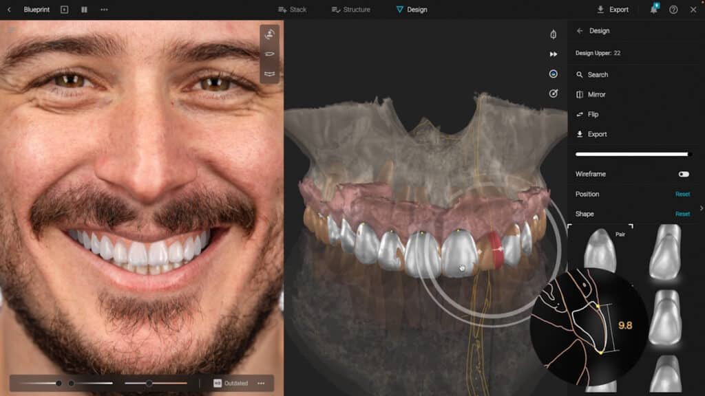 Simulare a zambetului in SmileCloud, pentru un barbat