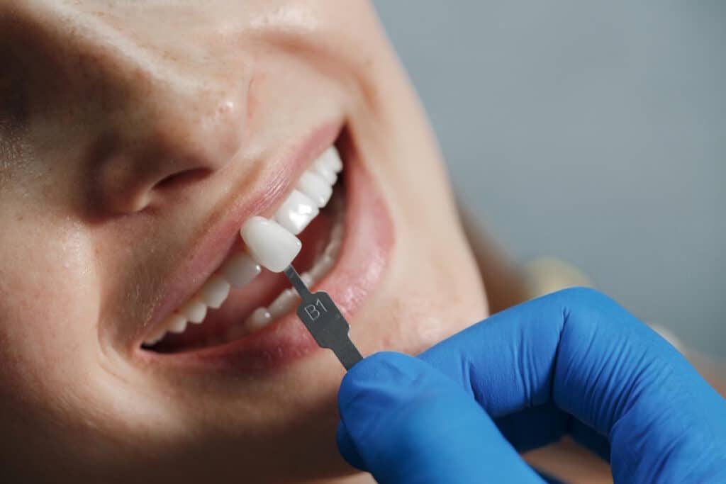 Medic stomatolog care testeaza culoarea fatetelor in cazul unei paciente