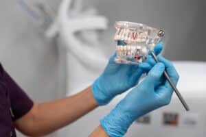 Medic care arata structura dintelui pe un mulaj dentar